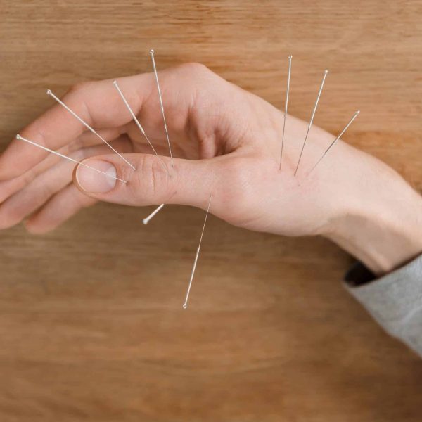 man-using-acupuncture-treatment-for-pain-relief-c-2022-11-11-10-11-07-utc-scaled.jpg